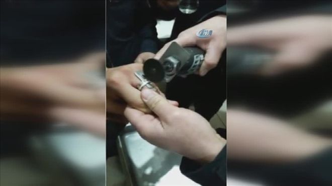 İtfaiyeden parmak kurtarma operasyonu