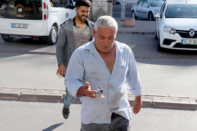 Acemi kasaplar, soluğu acil servislerde aldı 