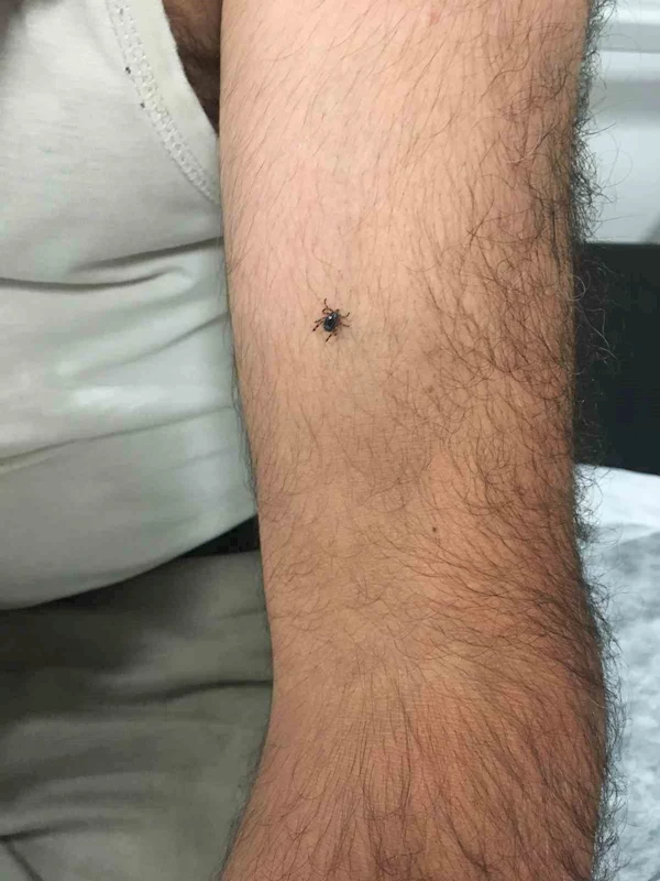 Kayseri’nin bir ilçesinde daha kene vakası
